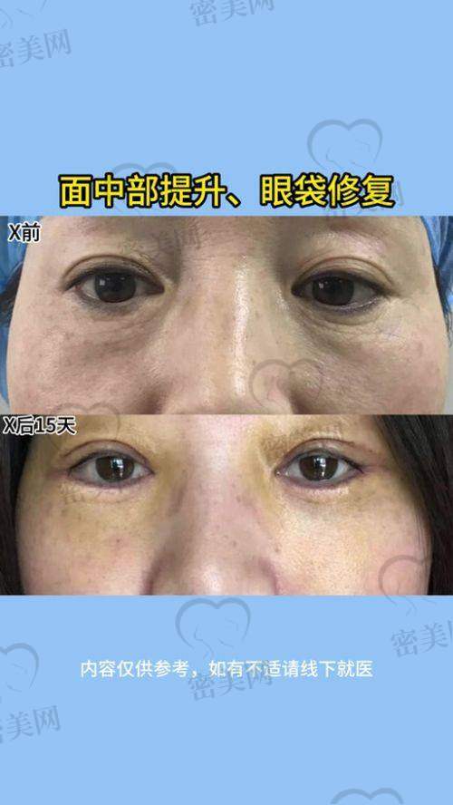 河南省职工医院王杨医生：地址+联系方式+挂号攻略大全