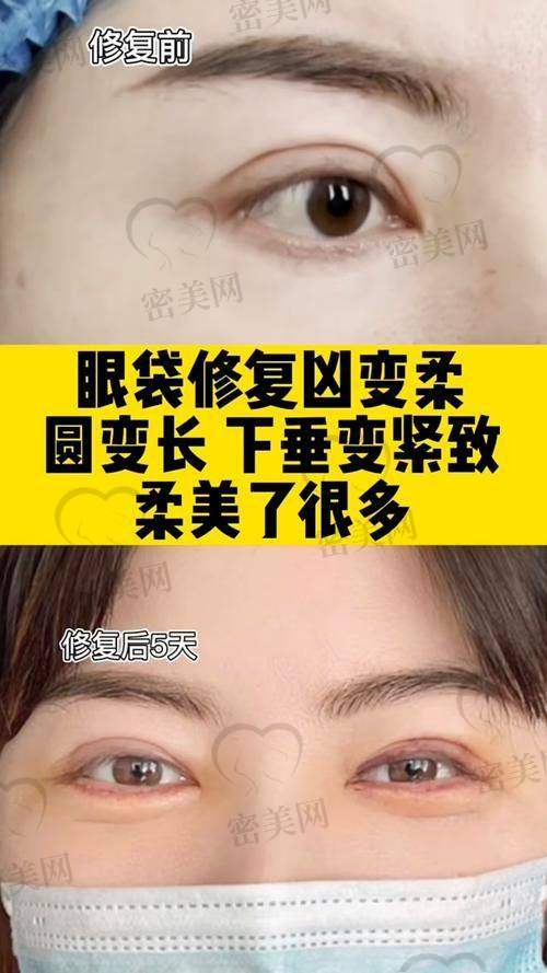 王杨医生口碑评价&术后护理贴士