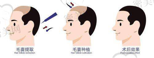 天津紫洁任晋峰眼周年轻化：口碑爆棚的“美丽密码”