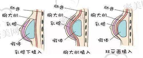 上海第九人民医院清奥重点医生技术亮点——郑志忠医生