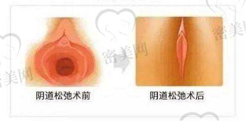 王苹医生怎么预约挂号？