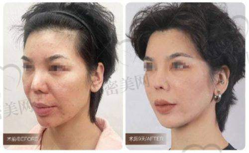 唐山芮蒂医疗美容门诊部是正规的吗？