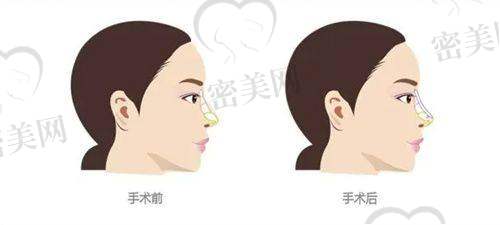嘉兴柏丽医疗美容医院：口碑式成长，乳房整形受欢迎