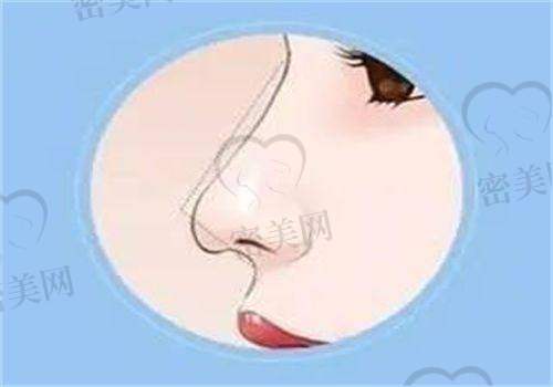 王苹医生口碑怎么样？