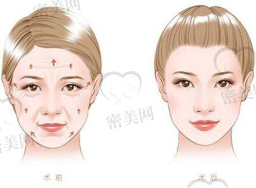 王冰医生口碑怎么样？