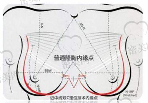 我亲测挂号成功的几个冷门操作，一般人不知道