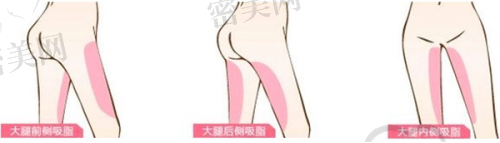 高国强医生擅长项目：