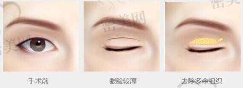 唐山芮蒂医疗美容门诊部价格表：