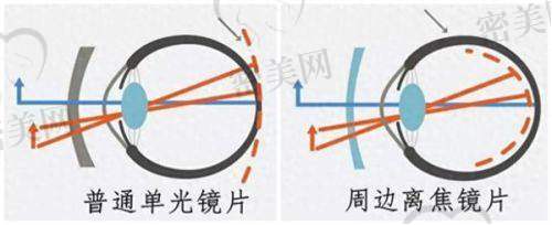 赵培泉医生挂号费用全解析：如何用较低价格看医生
