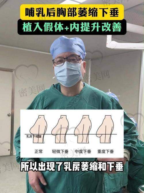 武汉纽菲思医疗美容门诊部：皮瓣重构 提升更牢靠