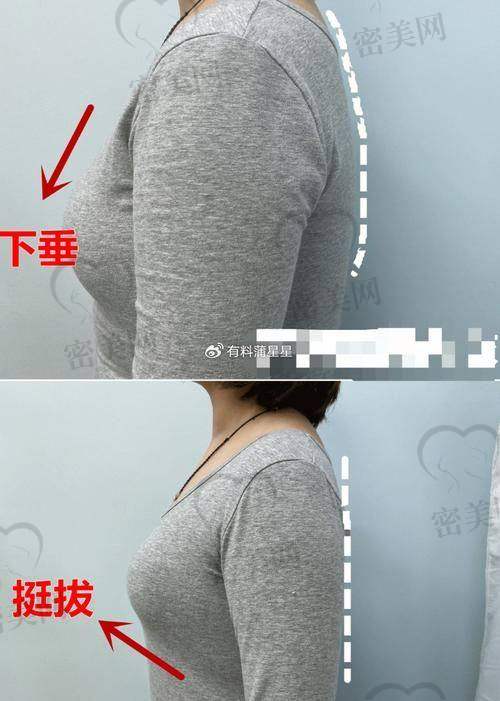 武汉艺星医疗美容医院：靠谱内窥镜提升鼻祖