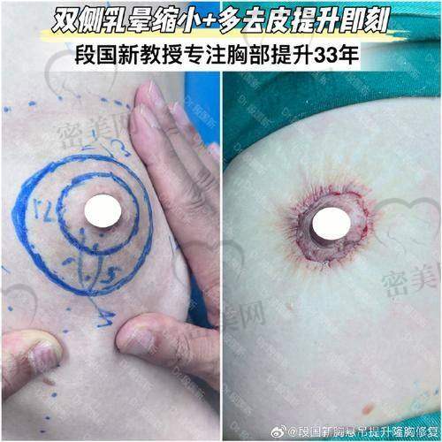 武汉华韩奇致医疗美容医院：黄金比例打造性感比例