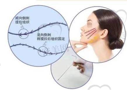 风筝小拉皮适合哪些人群？