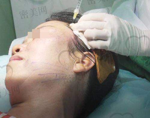 陈坦医生——广州韩妃风筝小拉皮核心技术人物