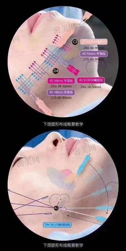 求美者真实反馈：术前术后差异明显，修复快