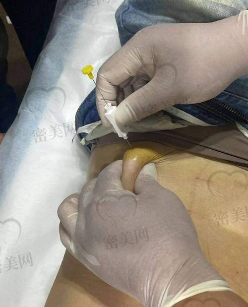 广州韩妃医院特色服务加分不少