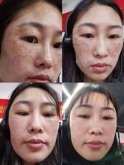 3、大连艺星医疗美容医院