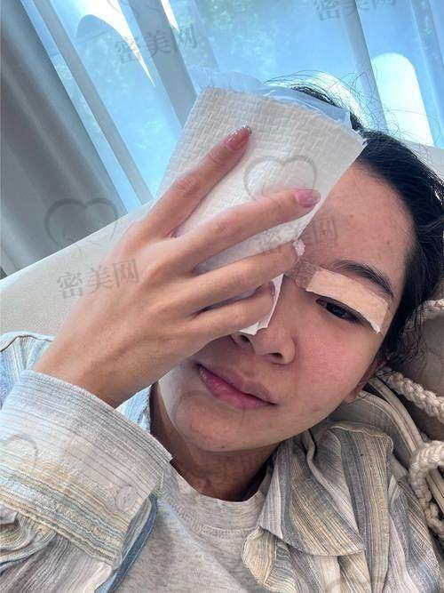 天津紫洁张金娥：3800 元开启梦幻双眼皮之旅