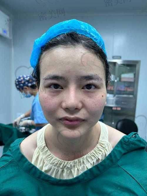 天津紫洁张金娥眼周年轻化：技术优势大揭秘