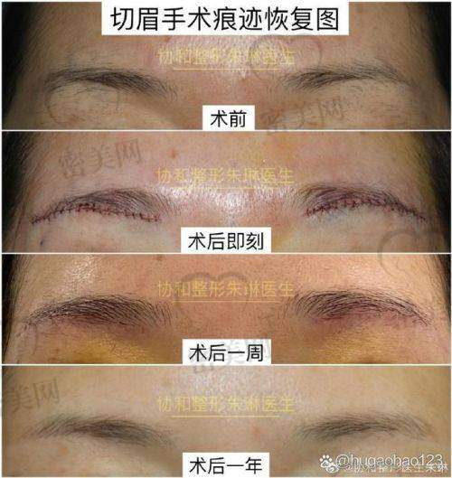 天津紫洁医疗美容郭栓全：眼周逆龄魔法师本人