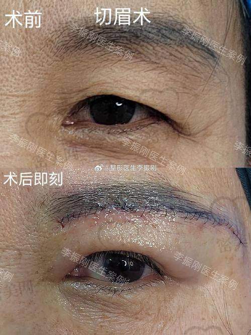 天津紫洁：眼周年轻化的“梦幻城堡”
