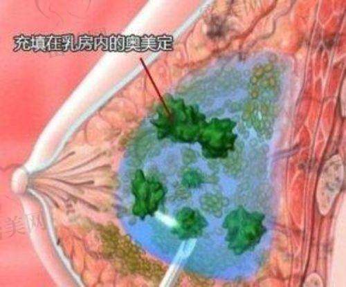 真实实例：术前术后对比见证实力