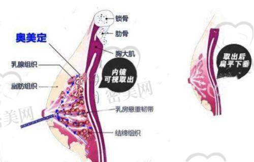 为什么越来越多的人选择瑞丽做异物取出手术？
