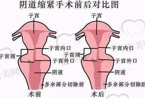 朗继春医生技术特点：