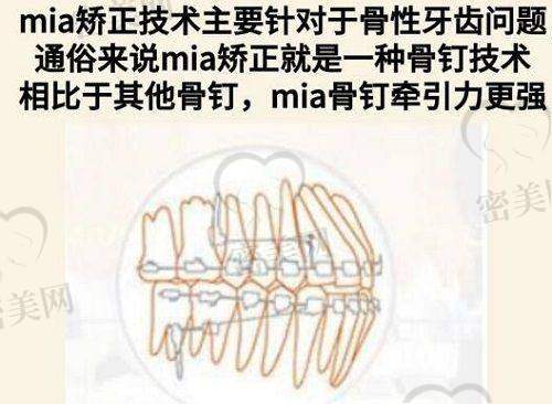 刘金华医生技术特点：