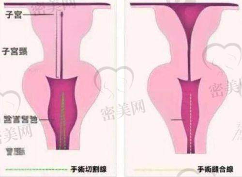 王文杰医生技术特点：