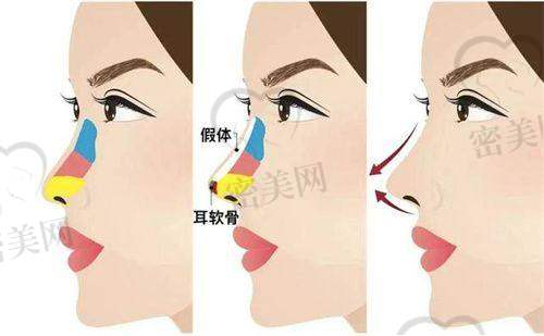 皮肤状态差?可以从以下皮肤美容项目中找到解决方案