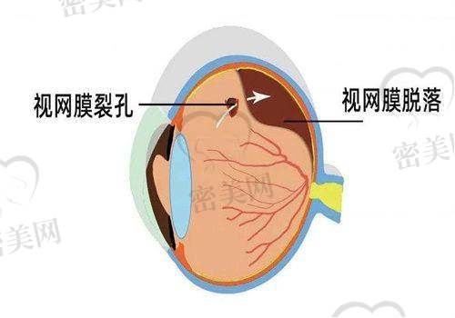 武汉爱尔眼科汉口医院是正规的吗？