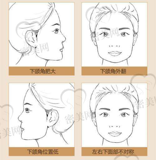 于兴洋医生技术特点：
