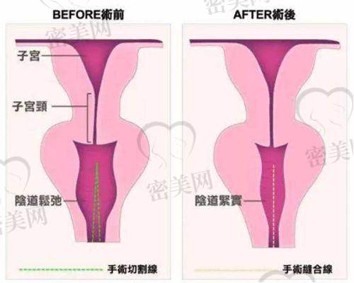 如何预约张海明医生？通道方式汇总