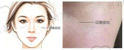 王军 医生口碑怎么样？