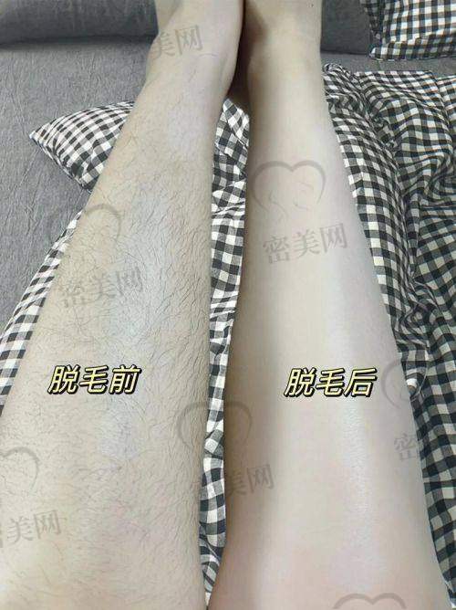 兰州梦想整形医院
