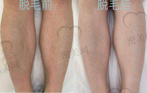 兰州皙妍丽医美