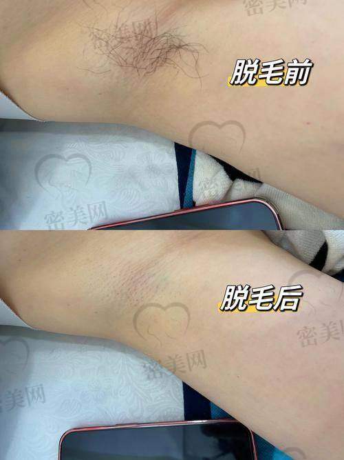 兰州可悦医美机构