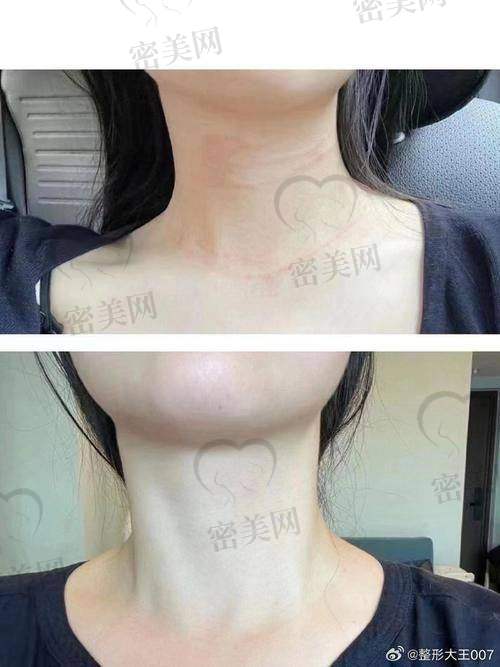 选对医院特别重要