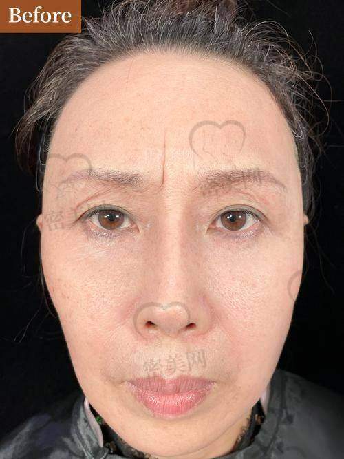日常预防小妙招