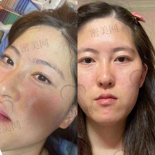 广东美恩整形美容医院：医术与服务双优的宝藏医院