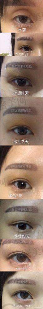 风险与注意事项