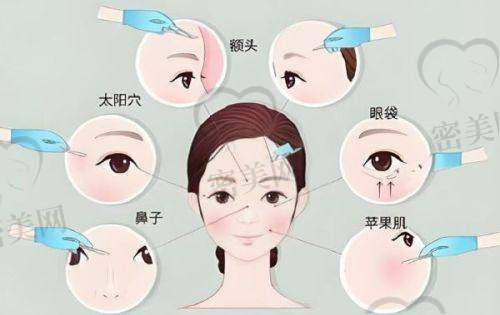 医院主推的热门整形项目有哪些？