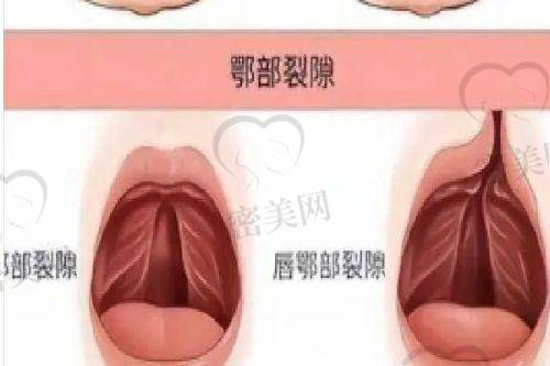 术前术后其他隐藏花费你也要知道