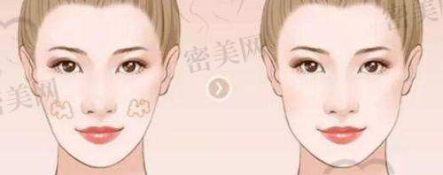 术后管理与服务保护不容忽视
