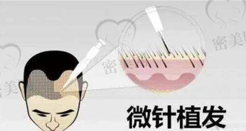 金华显赫植发口碑怎么样？