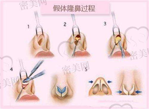 兰州崔大夫博士丽整形美容门诊部：主打眼综合，科技范儿十足