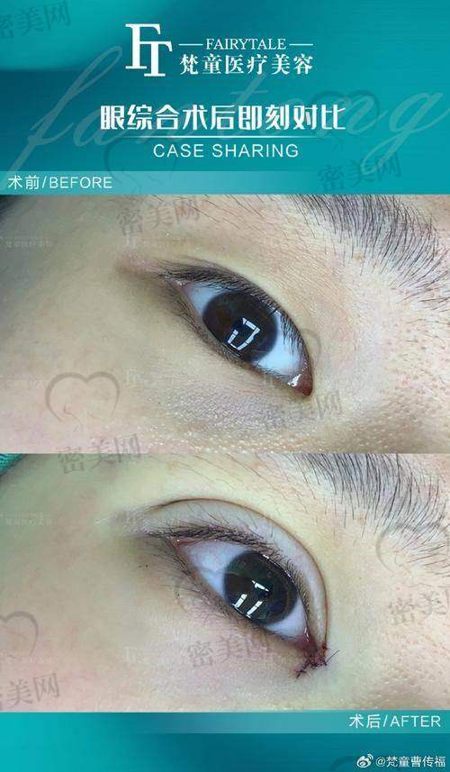 天津紫洁医疗美容郭栓：技术实力强的美容名咖