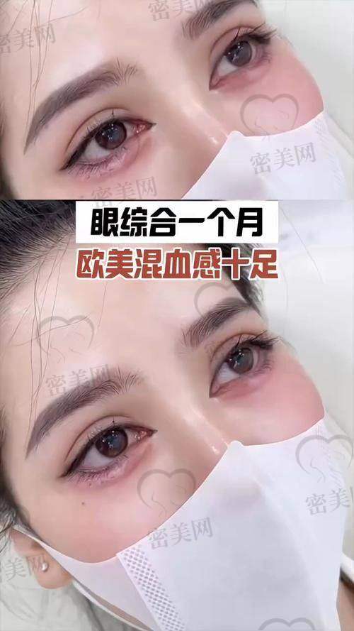 天津紫洁医疗美容郭栓全方面部年轻化真人实例