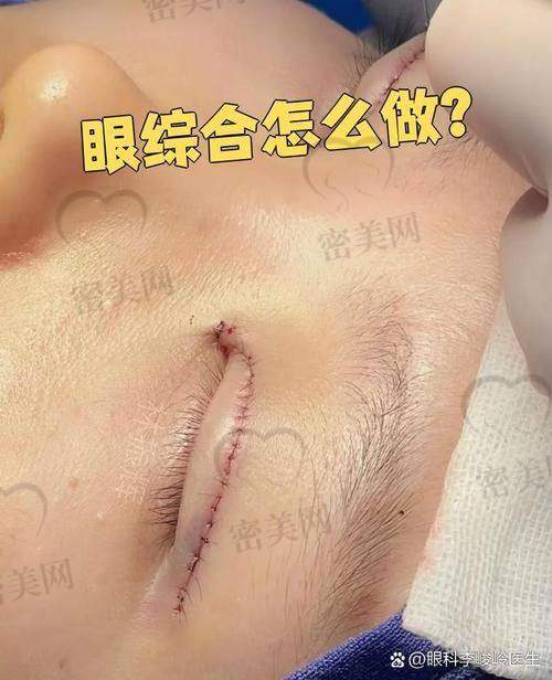 天津紫洁医疗美容郭栓全方面部年轻化的优势特色